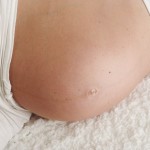 How safe is chiropractic during pregancy torbay Chiropractic Clinic